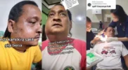 Viral Sakit Gigi Bengkak Parah, Ternyata Angina Ludwig: Infeksi Serius yang Bisa Mengancam Nyawa