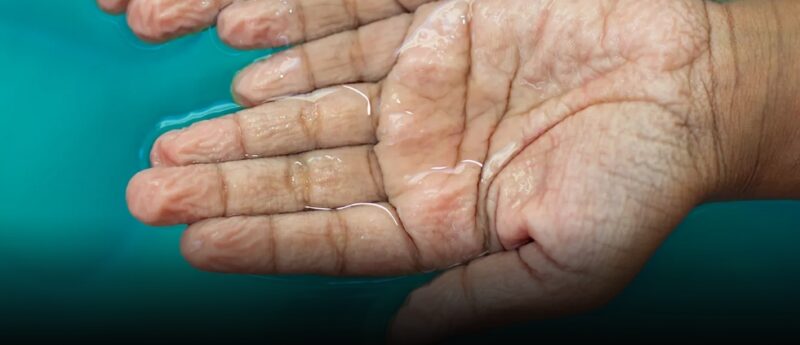 Fenomena jari keriput (pruney fingers) adalah reaksi aktif sistem saraf untuk beradaptasi dengan lingkungan basah. (Foto: .the-scientist.com/koransakti.co.id)