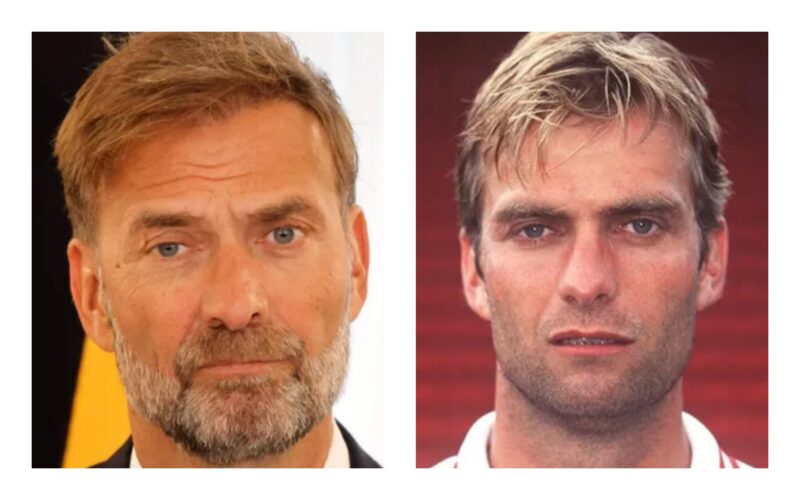 Jurgen Klopp